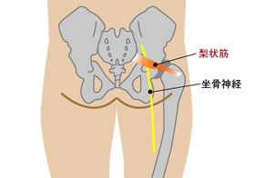 梨状筋症候群について 熊本市北区のおかもと弓削整骨院